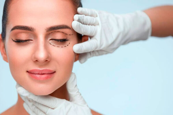 UNIDAD DE OCULOPLASTIA