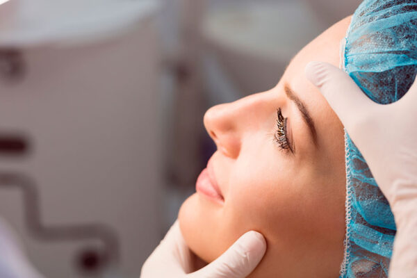 RINOPLASTIA