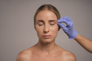 blefaroplastia en Barcelona y Tarragona